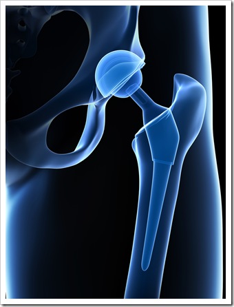 Back Pain Limerick PA Joint Replacement