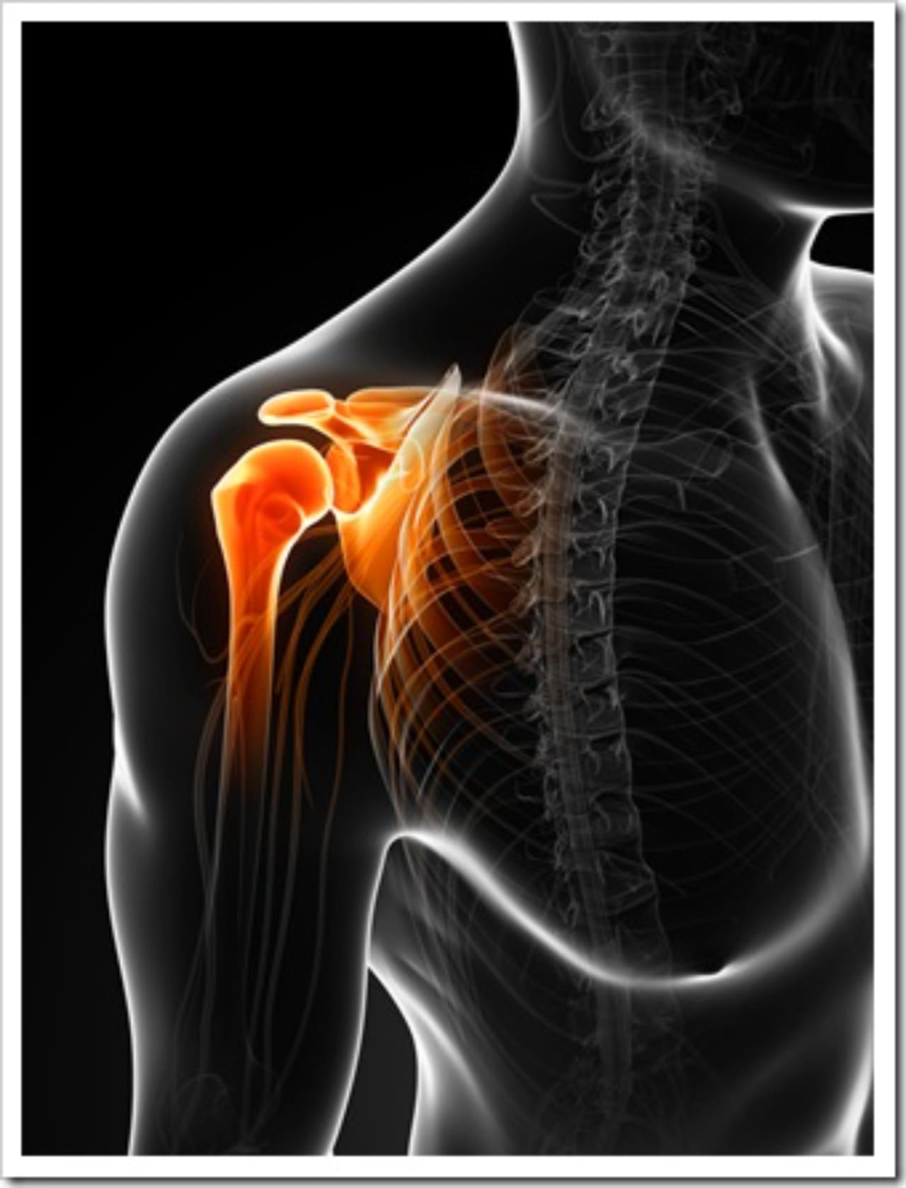 Frozen Shoulder Limerick PA Neck Pain
