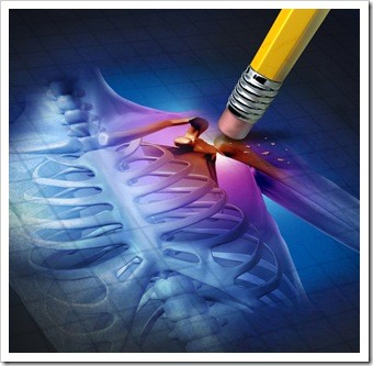 Scar Tissue Limerick PA Chiropractic